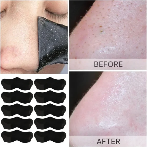 Unisex Blackhead Remove Mask Peel Nasal Strips Deep Cleansing Shrink Pore Nose Black Head Remove Stickers 1