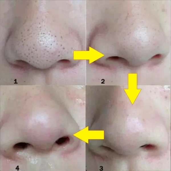 Unisex Blackhead Remove Mask Peel Nasal Strips Deep Cleansing Shrink Pore Nose Black Head Remove Stickers 3